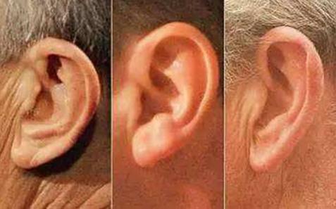 新花招掏耳朵骗局事先准备耳屎（图）