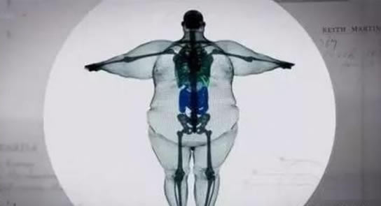 900斤男子扫描X光照片惊呆众人（图）