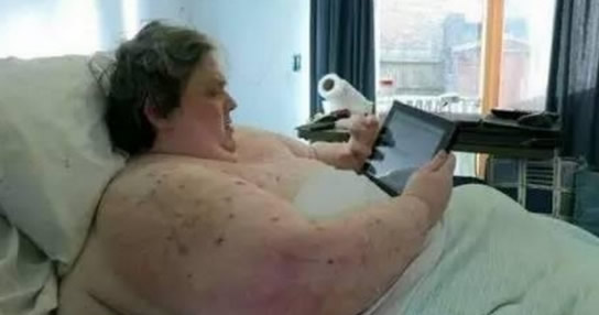 900斤男子扫描X光照片惊呆众人（图）