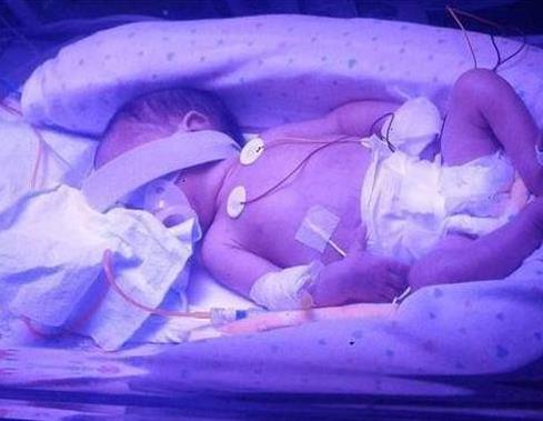 女子脑死亡107天后产下“奇迹宝宝”（母爱的伟大）