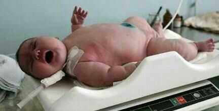 19岁女孩生下13.6斤巨婴原因让人瞠目结舌(图) 19岁女孩生下13.6斤巨婴原因让人瞠目结舌(图)