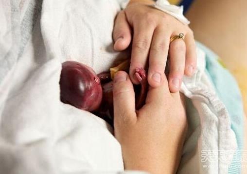 胎儿早产去世 小生命吓傻家人（不喜误入）