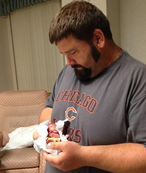 胎儿早产去世 小生命吓傻家人（不喜误入）