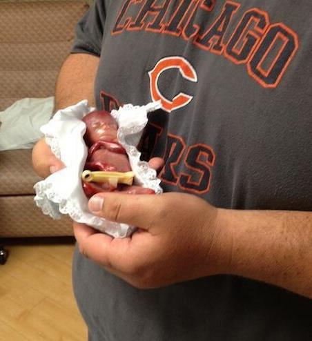 胎儿早产去世 小生命吓傻家人（不喜误入）