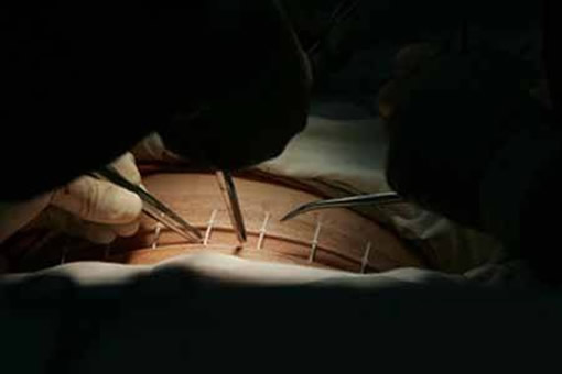 女子3次剖腹 打开肚子医生惊恐（图）