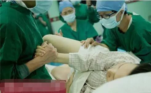 女子3次剖腹 打开肚子医生惊恐(图) 女子3次剖腹 打开肚子医生惊恐(图)