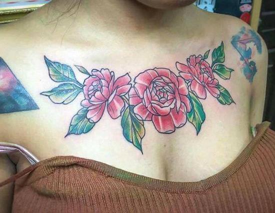 女大学生除胸前纹身被坑：不料留下触目惊心的疤痕