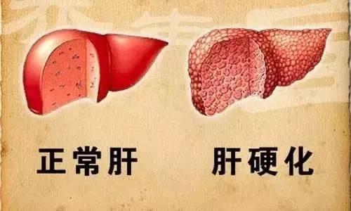 奇!睡前做了这事肾竟越来越好(全文) 奇!睡前做了这事肾竟越来越好(全文)