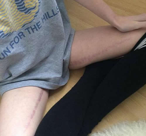 19岁少女掀开裙子 这幕震惊众人(图) 19岁少女掀开裙子 这幕震惊众人(图)