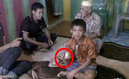 男童肛门竟产下蛋 专家鉴定确有其事（组图）