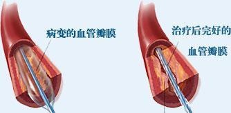 以为脚是静脉曲张 医生诊断后傻眼（全文）