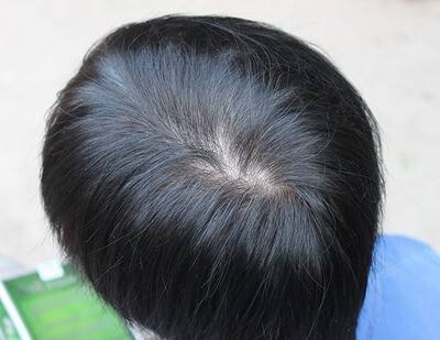 吃它让你到80岁都满头黑发(图) 吃它让你到80岁都满头黑发(图)