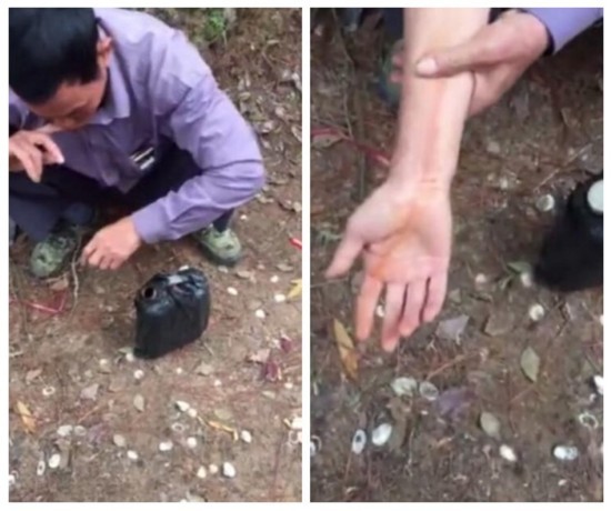 大叔被蛇咬伤后:竟这样自救（图）