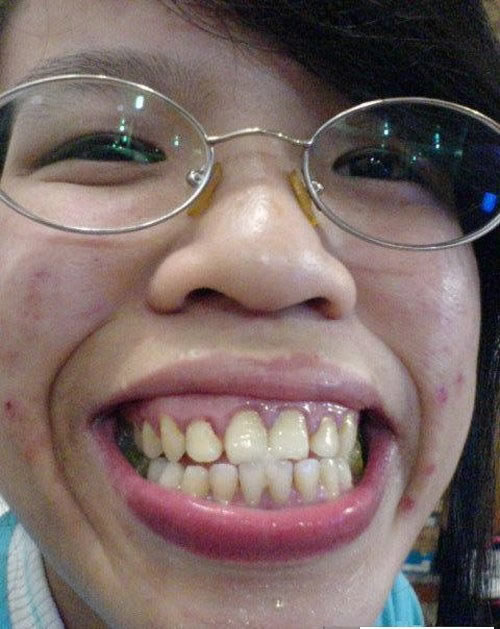 最丑女子组合：美女看烦了来看看最丑的20名女子