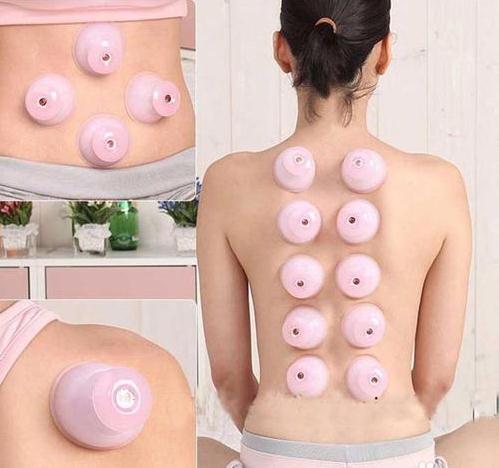 拔罐的好处和坏处：拔罐的作用详情全解析