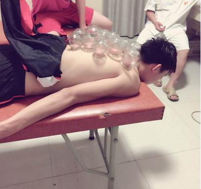 拔罐的好处和坏处：拔罐的作用详情全解析