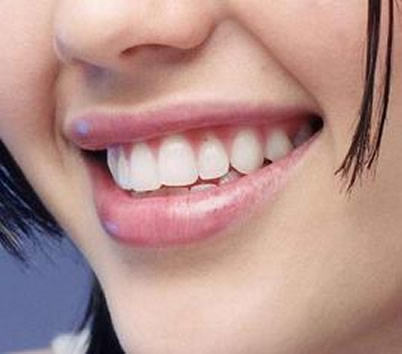 牙齿发黄变白小窍门:牙齿黄原因及怎么办