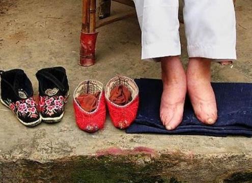 猪蹄一样的三寸金莲让人触目惊心:看看这样美吗? 猪蹄一样的三寸金莲让人触目惊心:看看这样美吗?