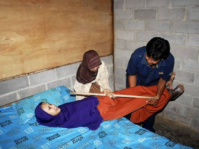 罕见怪病！女子全身像木头一样硬（图）