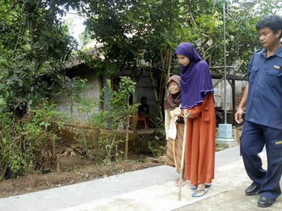 罕见怪病！女子全身像木头一样硬（图）