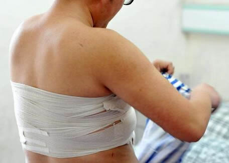 男子长出女人胸真相竟是这样（图）