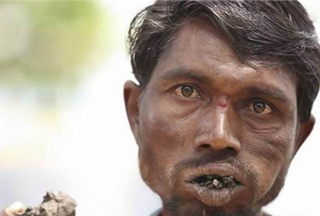 女子一周吃3斤石头真相让人无语(图) 女子一周吃3斤石头真相让人无语(图)