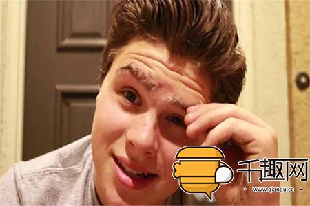 男子往脸上涂乳胶漆撕下奇迹出现（组图）