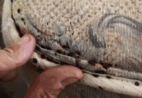 女子浑身瘙痒难忍 掀床单惊呆! 女子浑身瘙痒难忍 掀床单惊呆!