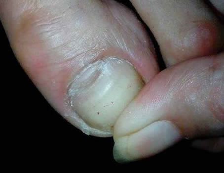 脚丫子告诉你的身体健康信息:你收到了吗? 脚丫子告诉你的身体健康信息:你收到了吗?