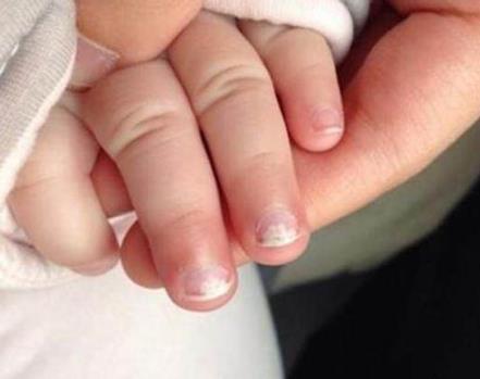 家长注意孩子这几个部位不能打（图）