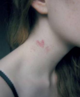 被种草莓的图片大全：早恋种草莓印图片欣赏