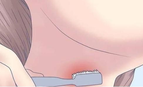 被种草莓的图片大全：早恋种草莓印图片欣赏