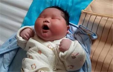 儿子生后总不睁眼 医生:他懒得睁(图) 儿子生后总不睁眼 医生:他懒得睁(图)