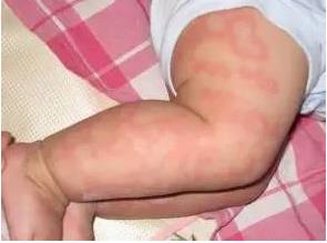 快过年了,不要喂我孩子吃这些食物（图）