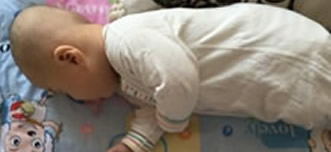 因宝妈没在意这宝宝头似平底锅（图）