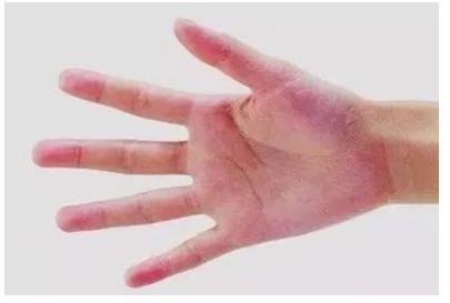 肝脏好不好,看四个地方就知道,教你如何自测