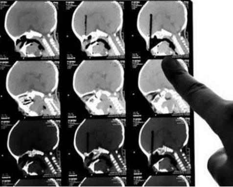 再好看也不能买的家具,快处理掉!能挽救孩子生命 再好看也不能买的家具,快处理掉!能挽救孩子生命