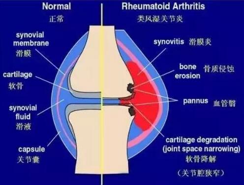 每天走多少步最健康：每天步行多少步合适揭晓