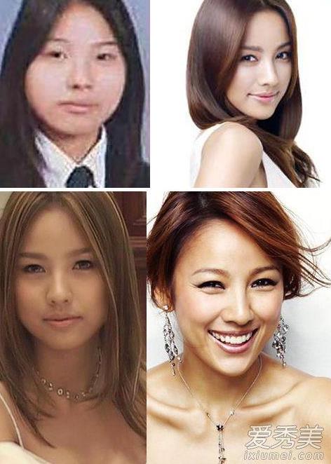 隆胸的明星:哪些明星隆胸【公开承认整容隆胸】 隆胸的明星:哪些明星隆胸【公开承认整容隆胸】