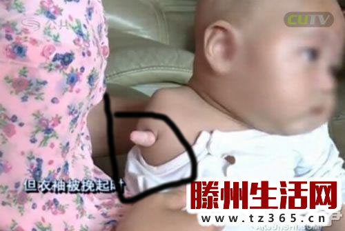 婴儿竟长了这个!家长看后大哭(组图) 婴儿竟长了这个!家长看后大哭(组图)