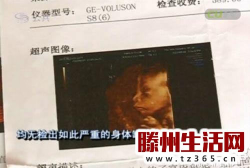 婴儿竟长了这个!家长看后大哭(组图) 婴儿竟长了这个!家长看后大哭(组图)
