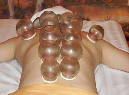 哪些人不适合拔火罐治疗感冒：把管有什么好处