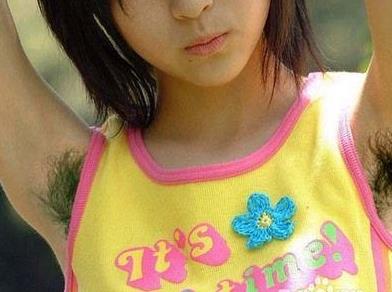 腋毛怎么去除最好：教你怎么去腋毛最好（图）