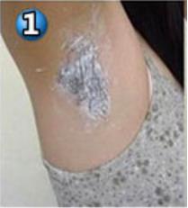 腋毛怎么去除最好：教你怎么去腋毛最好（图）