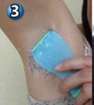 腋毛怎么去除最好：教你怎么去腋毛最好（图）