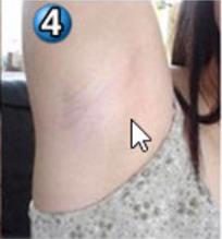 腋毛怎么去除最好：教你怎么去腋毛最好（图）