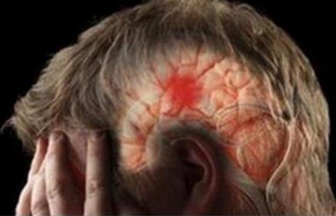 脑血栓竟有这前兆知道一个能救命（图）