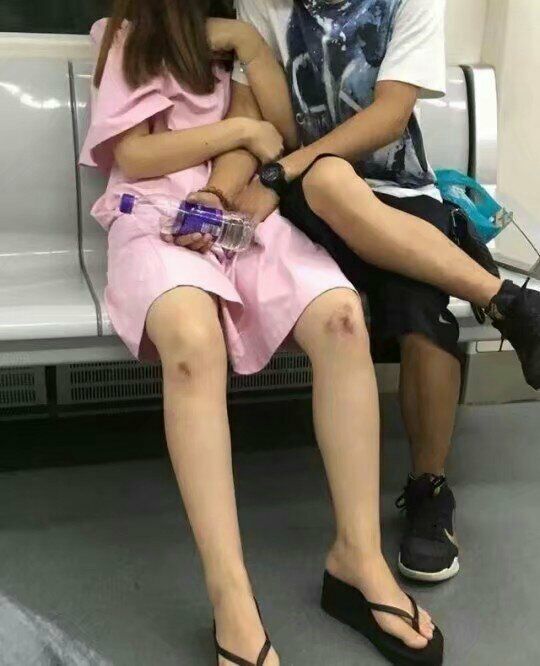 小伙子，你把媳妇伤成这样也就算了，公交车上还这样