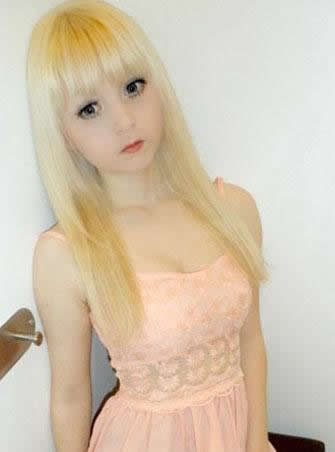 白化病能活多久：得了白化病能活多久？