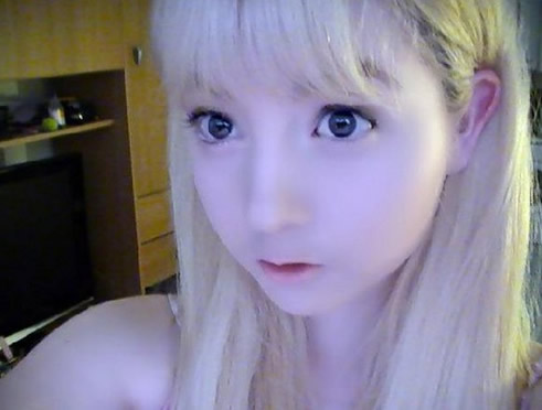 白化病能活多久：得了白化病能活多久？